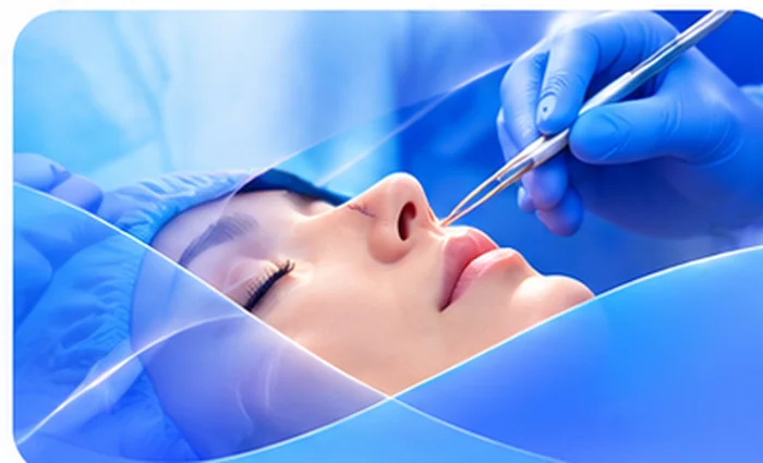 Steps of Rhinoplasty